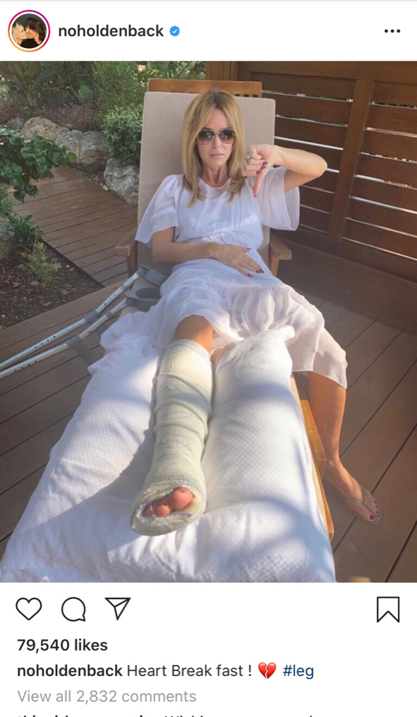 Amanda Holden Leg Injury