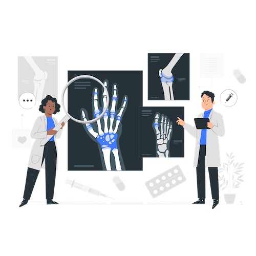 illustration of two doctors inspecting hand joints for pain