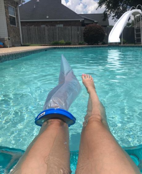 leg cast cover pool
