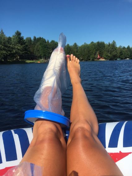 leg cast cover on a lake