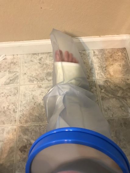 water proof leg cast cover review
