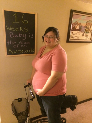 Jennifer from Topeka, pregnant on a knee scooter