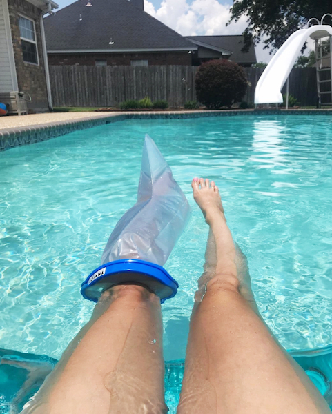 woman with cast cover sitting next to pool