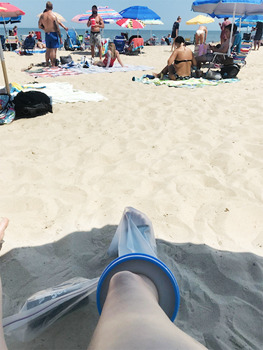 woman with cast cover at the beach